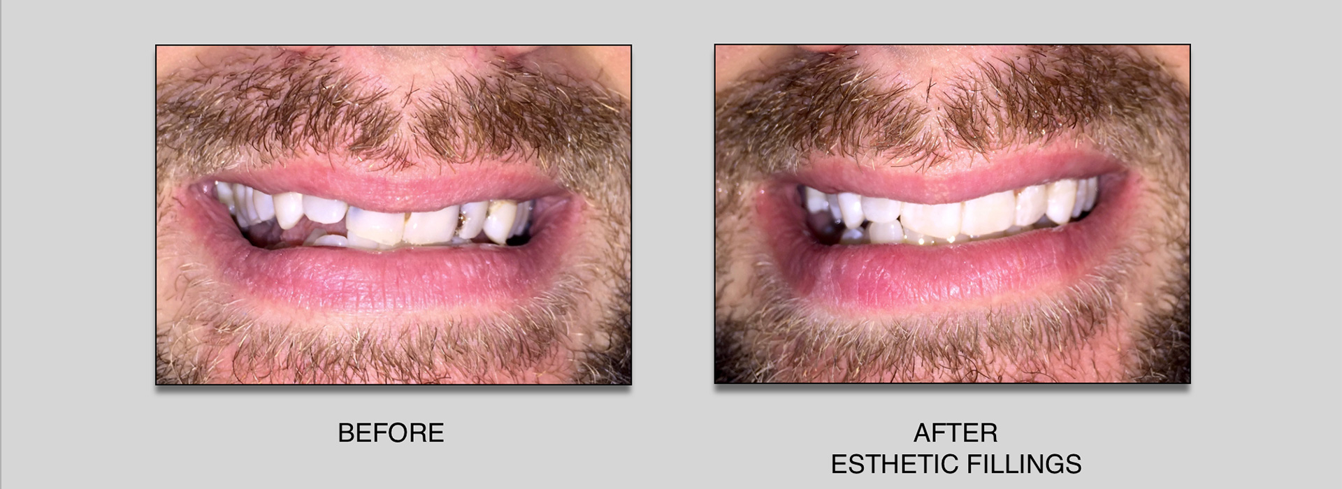 EF-l.jpg