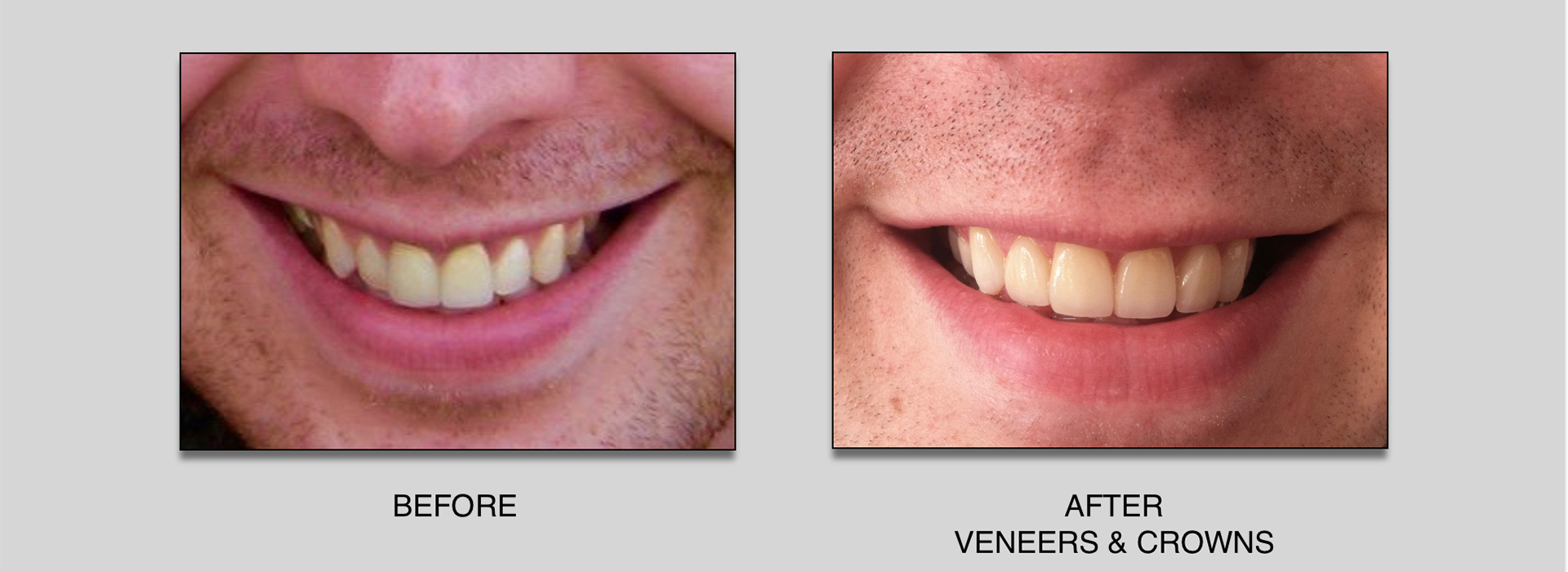 VC3-l.jpg